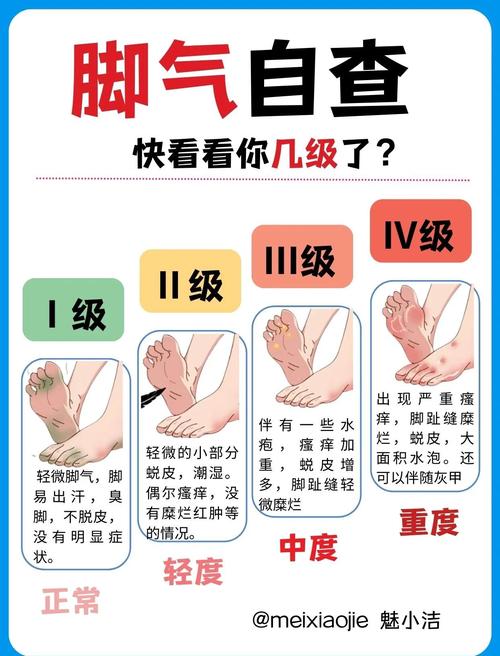 脚下的正常生活最新指南：警惕脚部疾病信号，呵护健康足部