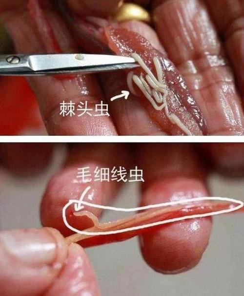 安全可靠的内部寄生虫下载地址,快来下载体验!