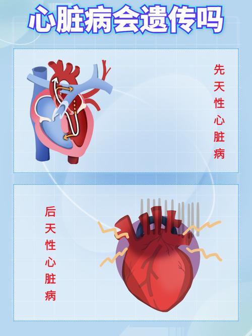想下载心脏问题官方正式版最新版,这些要点要知道!